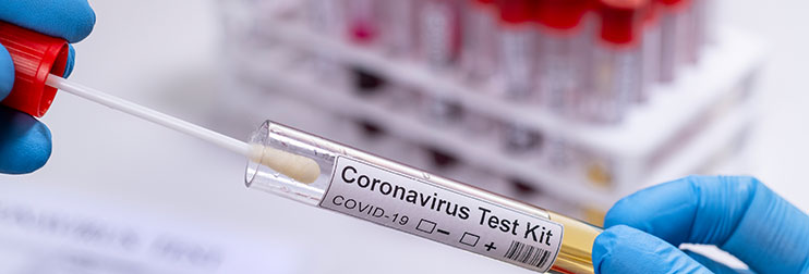 Coronavirus Testung Röhrchen mit Teststab