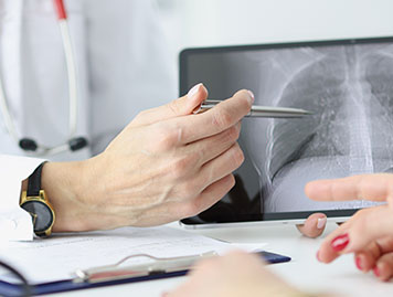 Arzt zeigt mit einem Stift auf eine Stelle auf einem Röntgenbild, das die Lunge zeigt.